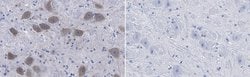 VAChT Mouse anti-Rat, Clone: N425/45, MilliporeSigma 25 &mu;g; Unconjugated:Antibodies,